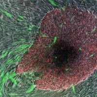 Le cellule staminali “indotte” compiono entusiasmanti progressi